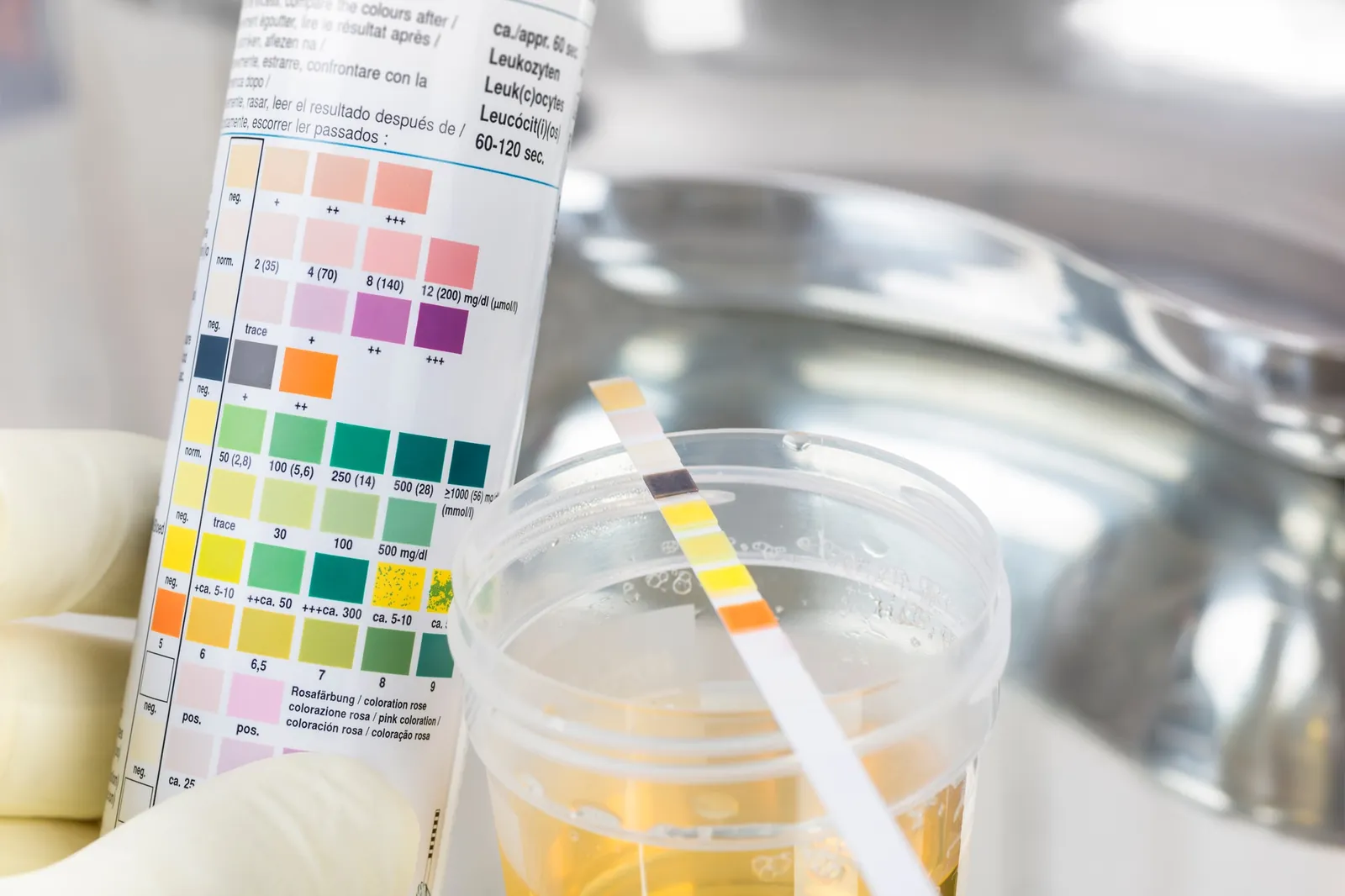 Blood & Urine Tests